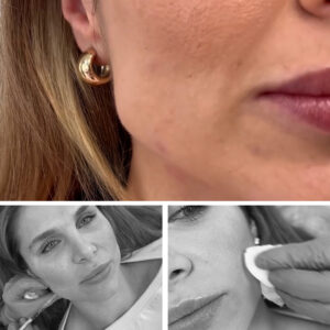 bruxismo-clinicas-diego-de-leon