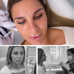 marcacion-mandibular-clinicas-diego-de-leon